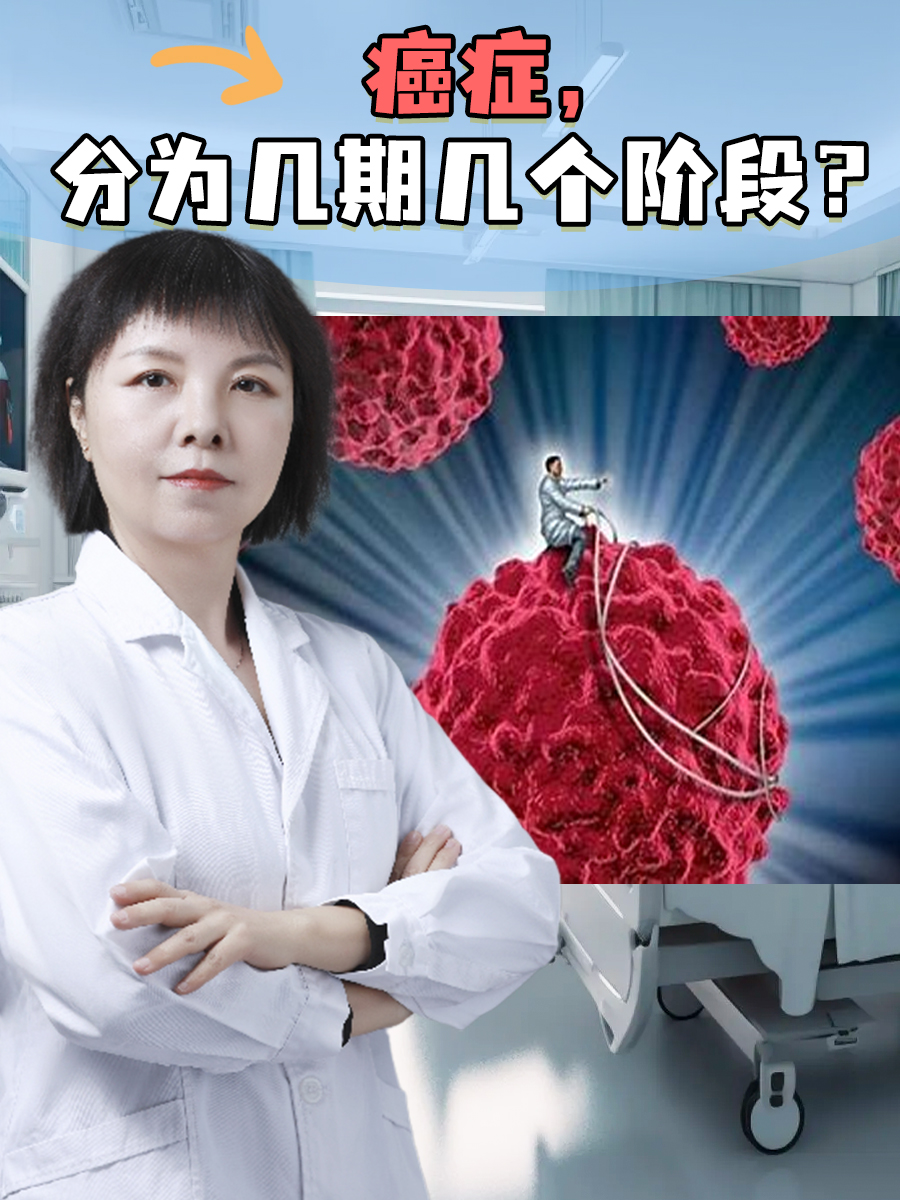 癌症，分为几期几个阶段？