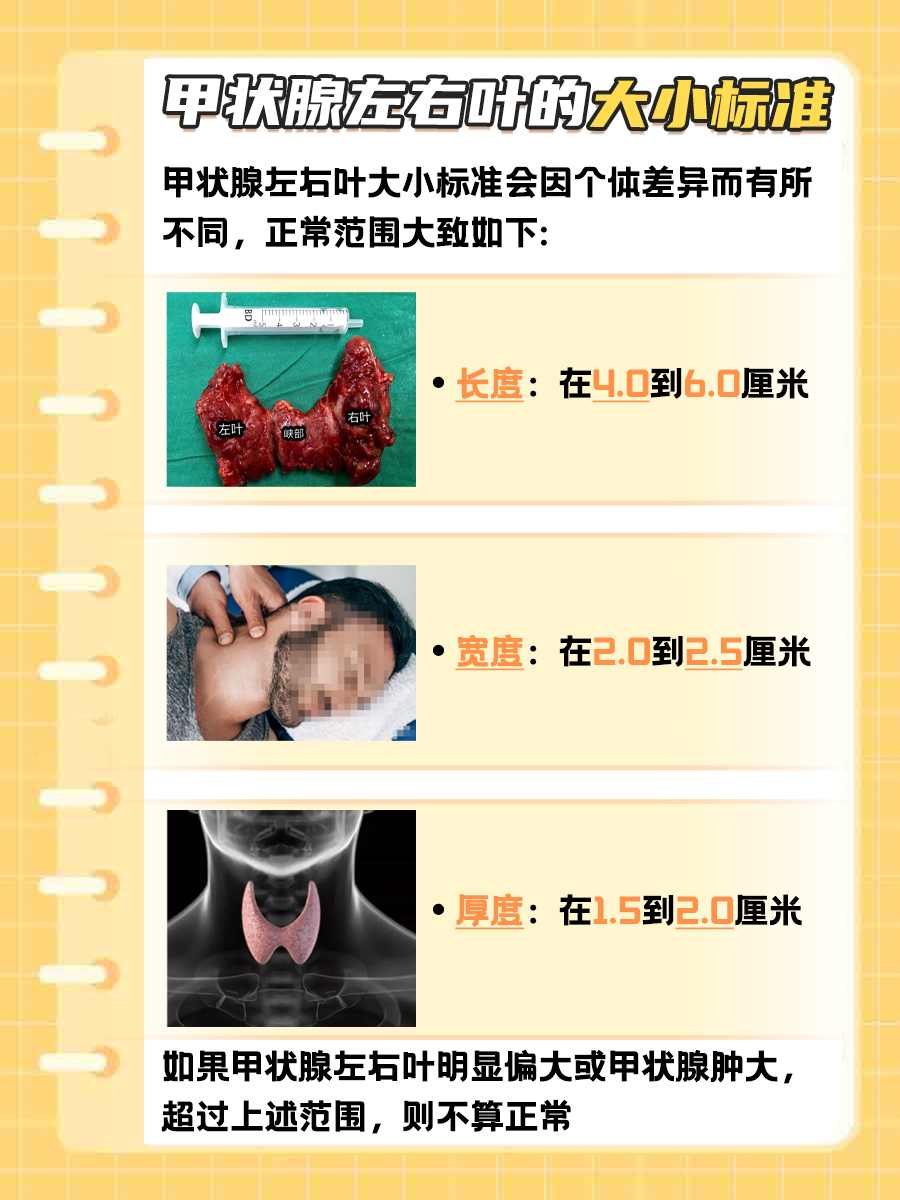 甲状腺左右叶多大才算正常呢？进来了解一下