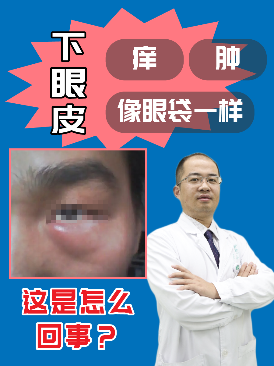 下眼皮痒、肿，像眼袋一样，这是怎么回事？