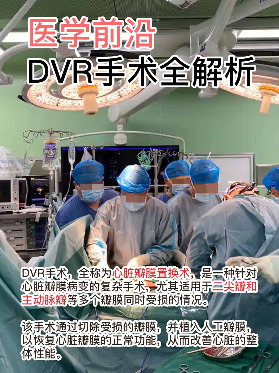 医学前沿:DVR手术全解析