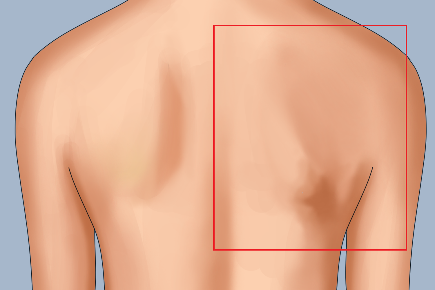 多发性肌炎 多发性肌炎
