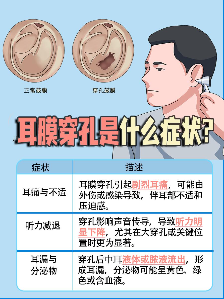 耳膜穿孔是什么症状?一文解析