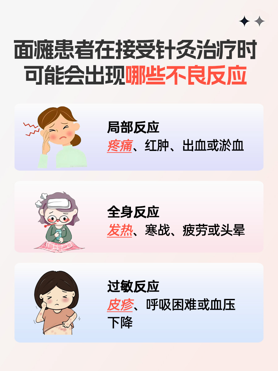 面瘫针灸治疗，找准这些部位！