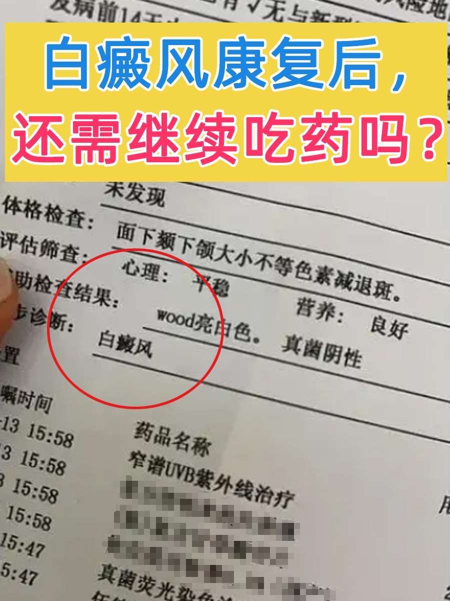 白癜风康复后,还需继续吃药吗?