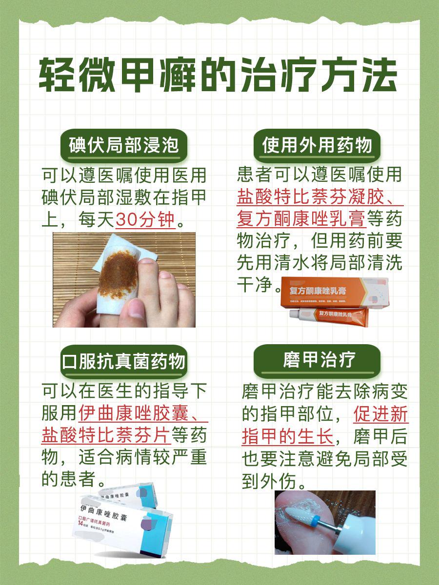 轻松告别轻微灰指甲！了解治疗方法，重拾健康美甲