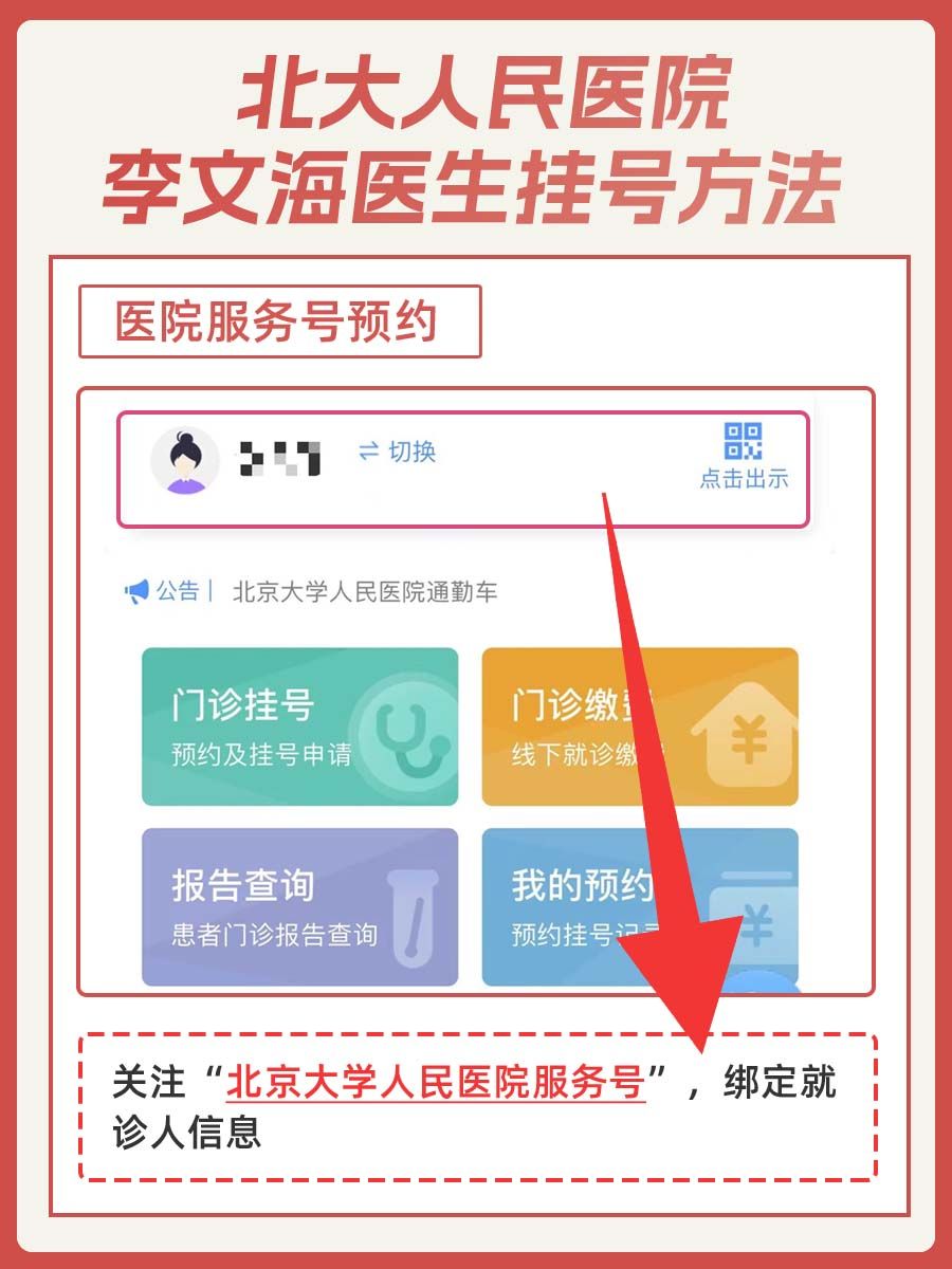 北大人民医院李文海医生怎么样?怎么挂号?