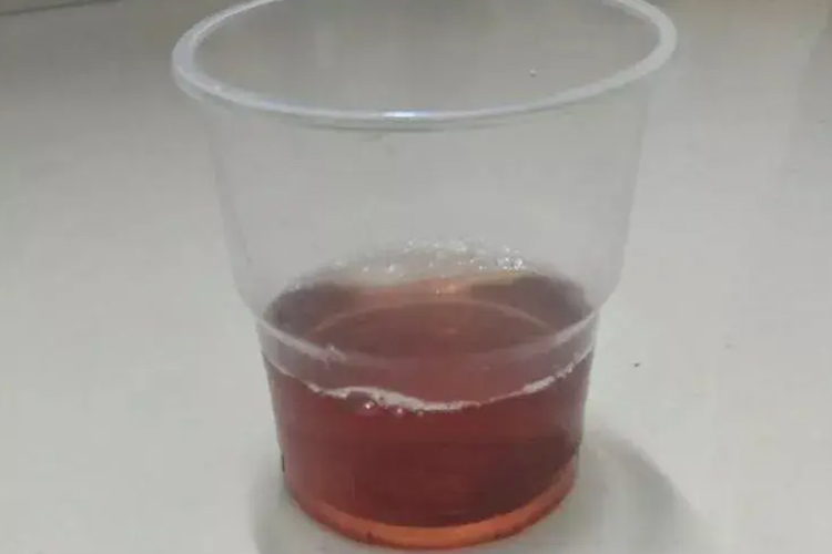 酱油色小便图