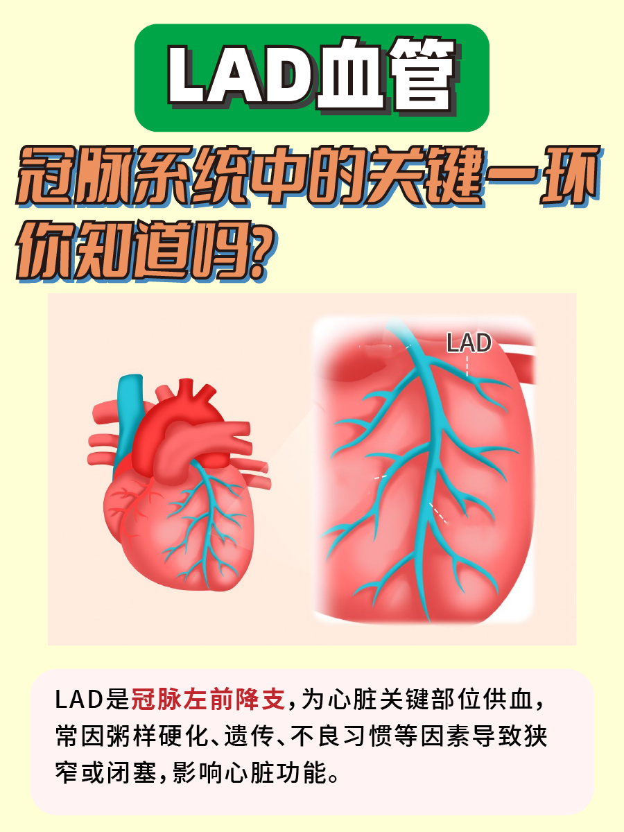 LAD血管：冠脉系统中的关键一环，你知道吗？