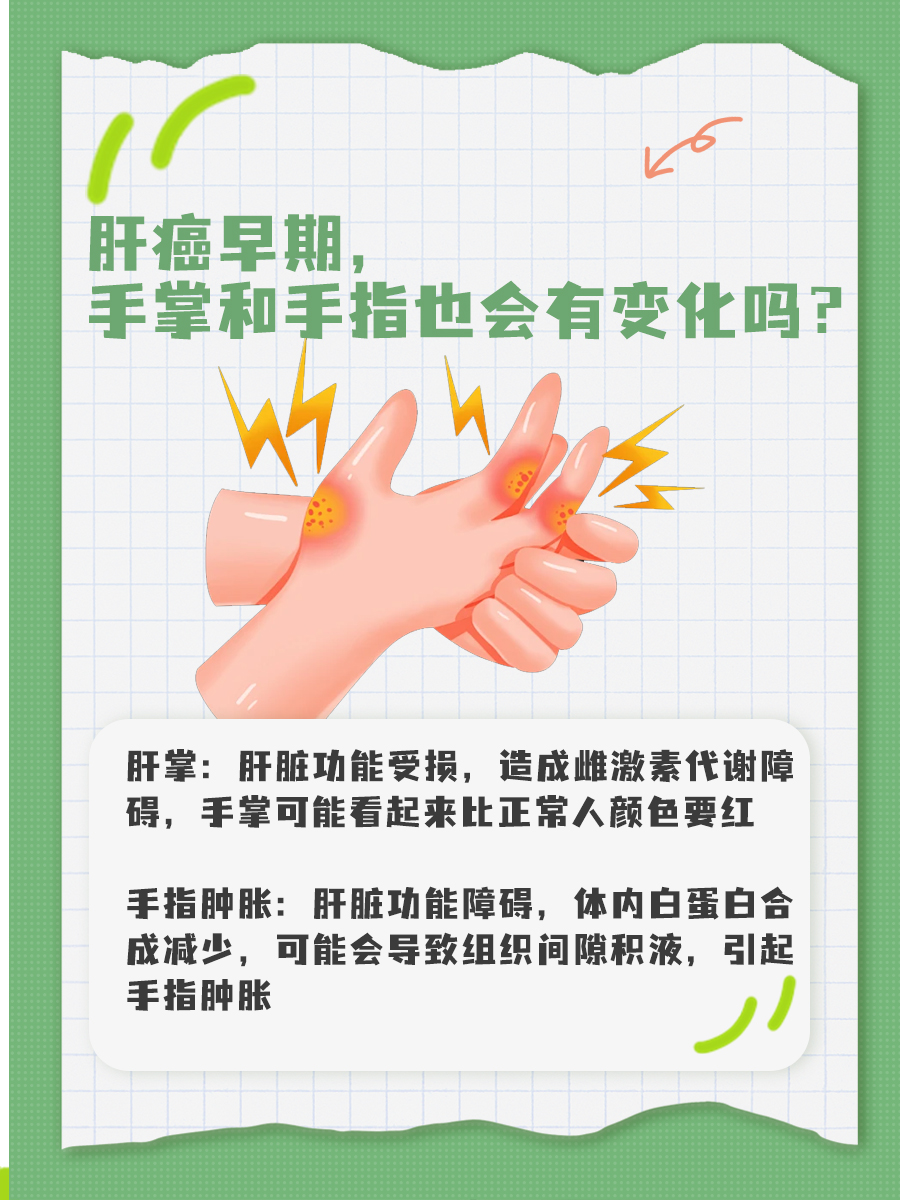 指甲出现这些变化,当心肝癌!