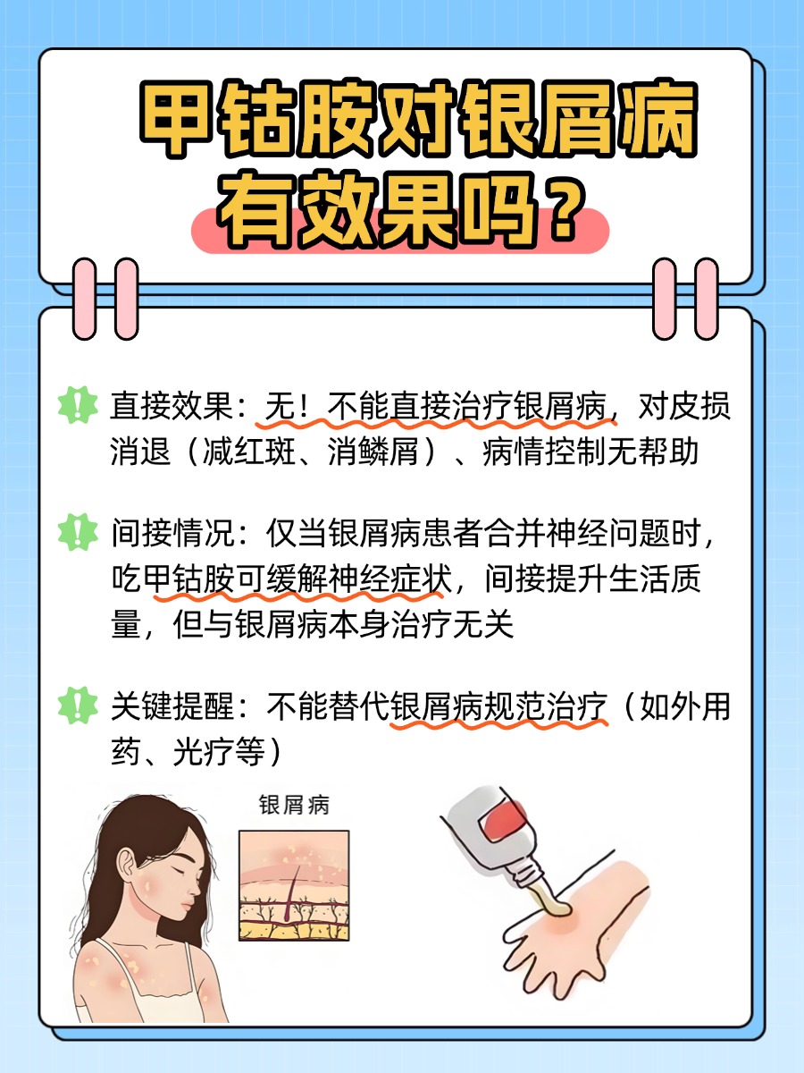 银屑病能吃甲钴胺吗有效果吗？别乱吃！