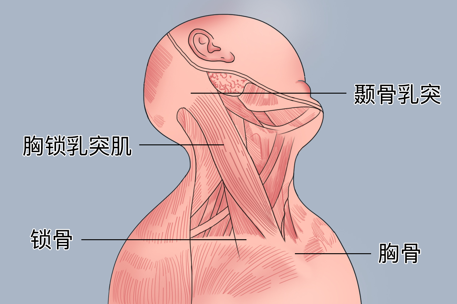 婴儿胸锁乳突肌位置图 婴儿胸锁乳突肌位置图