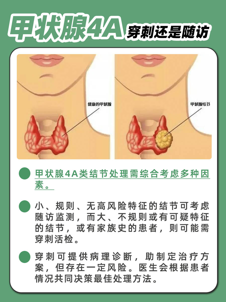 甲状腺4A穿刺还是随访？专家建议来了！