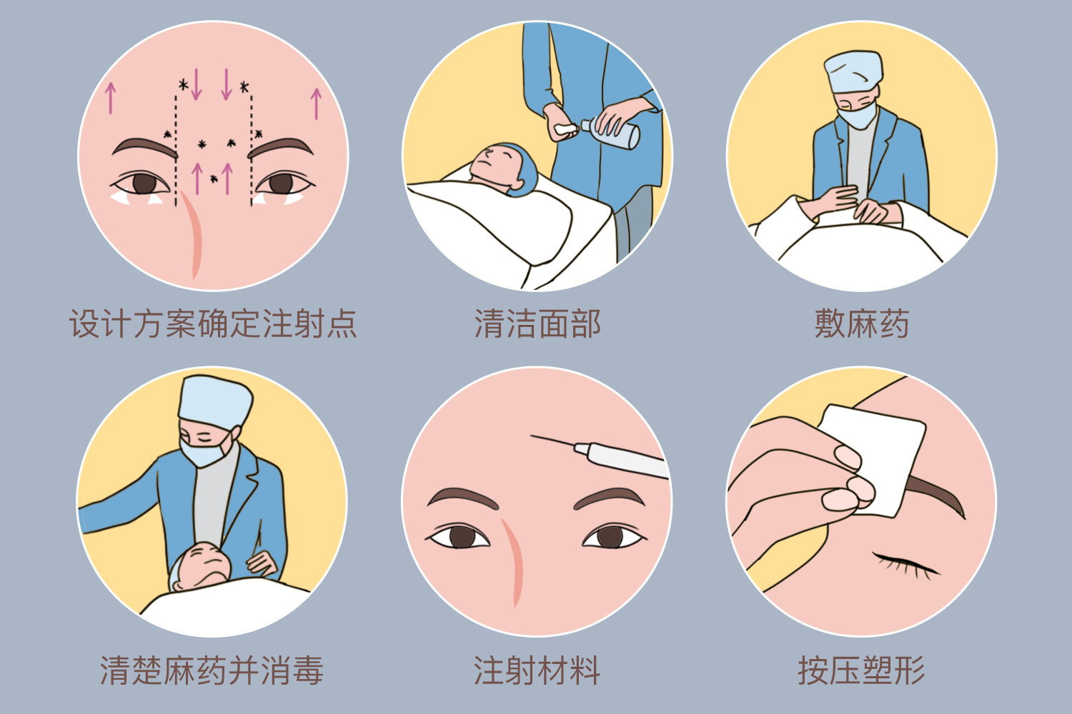 玻尿酸的注射方法图