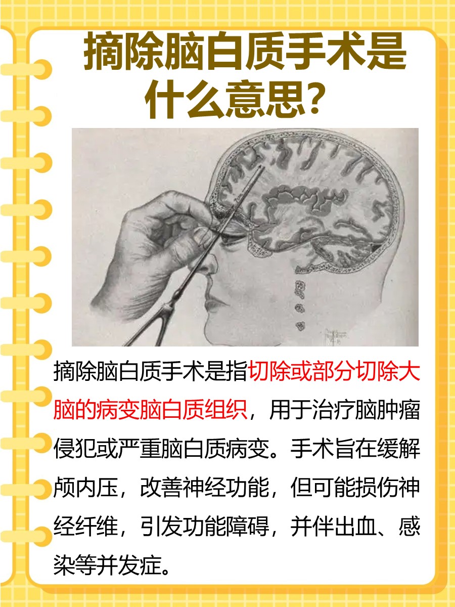 摘除脑白质手术是什么意思 ，医生解答！