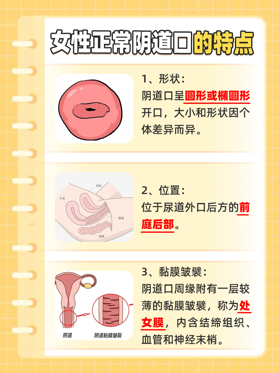 女性正常阴道口图片