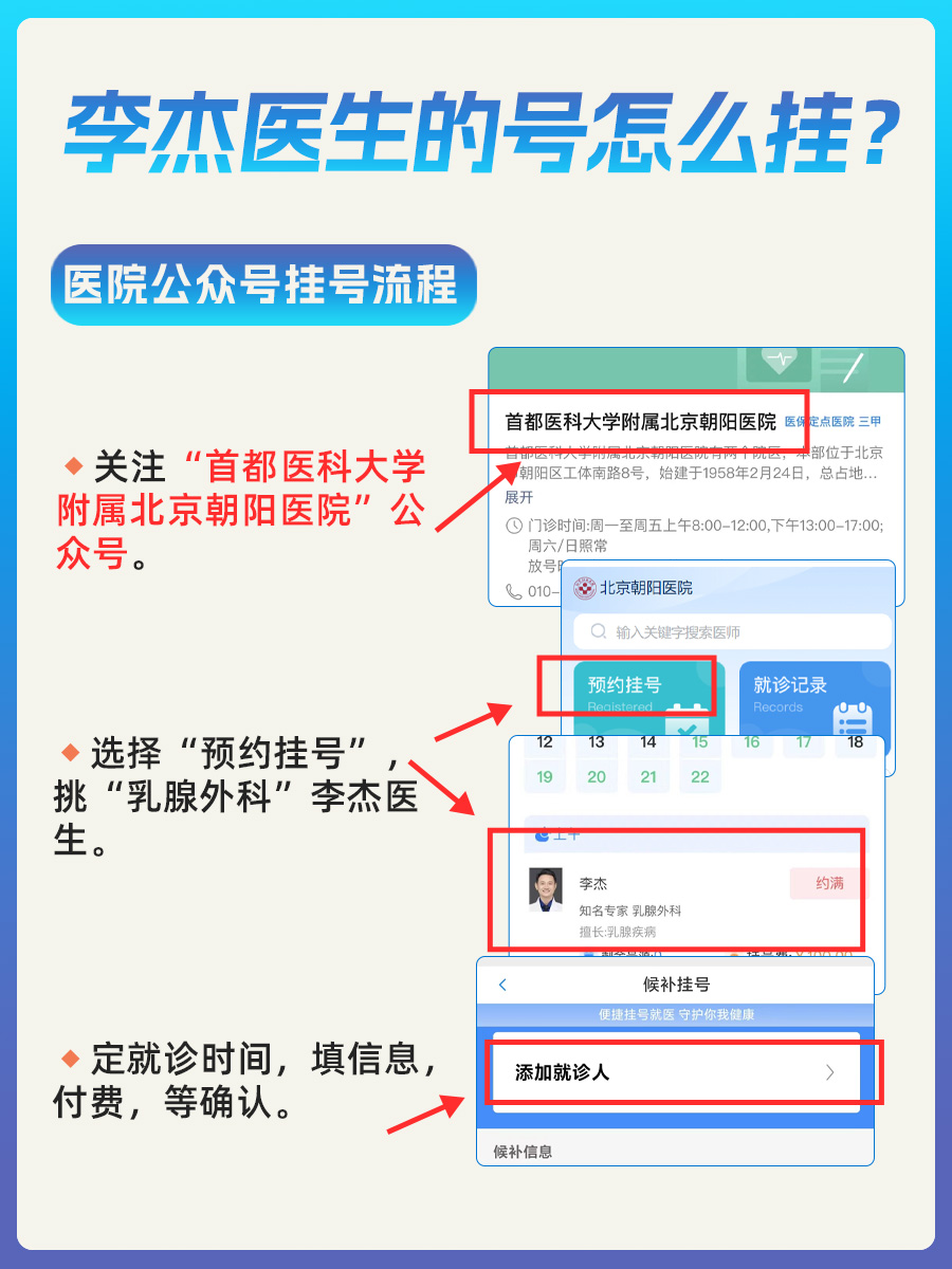 北京朝阳医院李杰医生怎么样？怎么挂号？