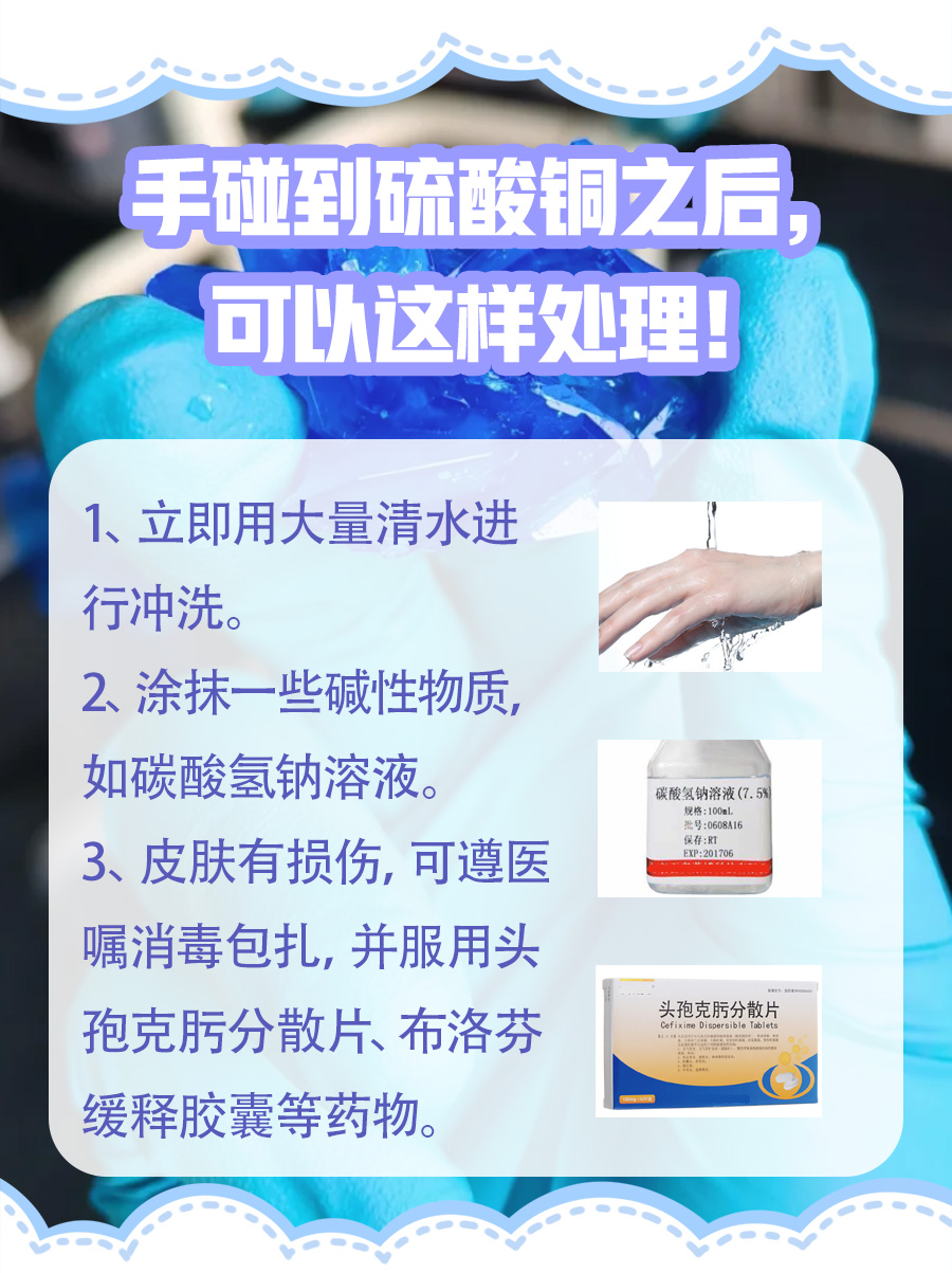 揭秘｜手碰到了硫酸铜会不会中毒？