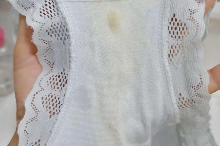 怀孕时内裤上乳白色分泌物图