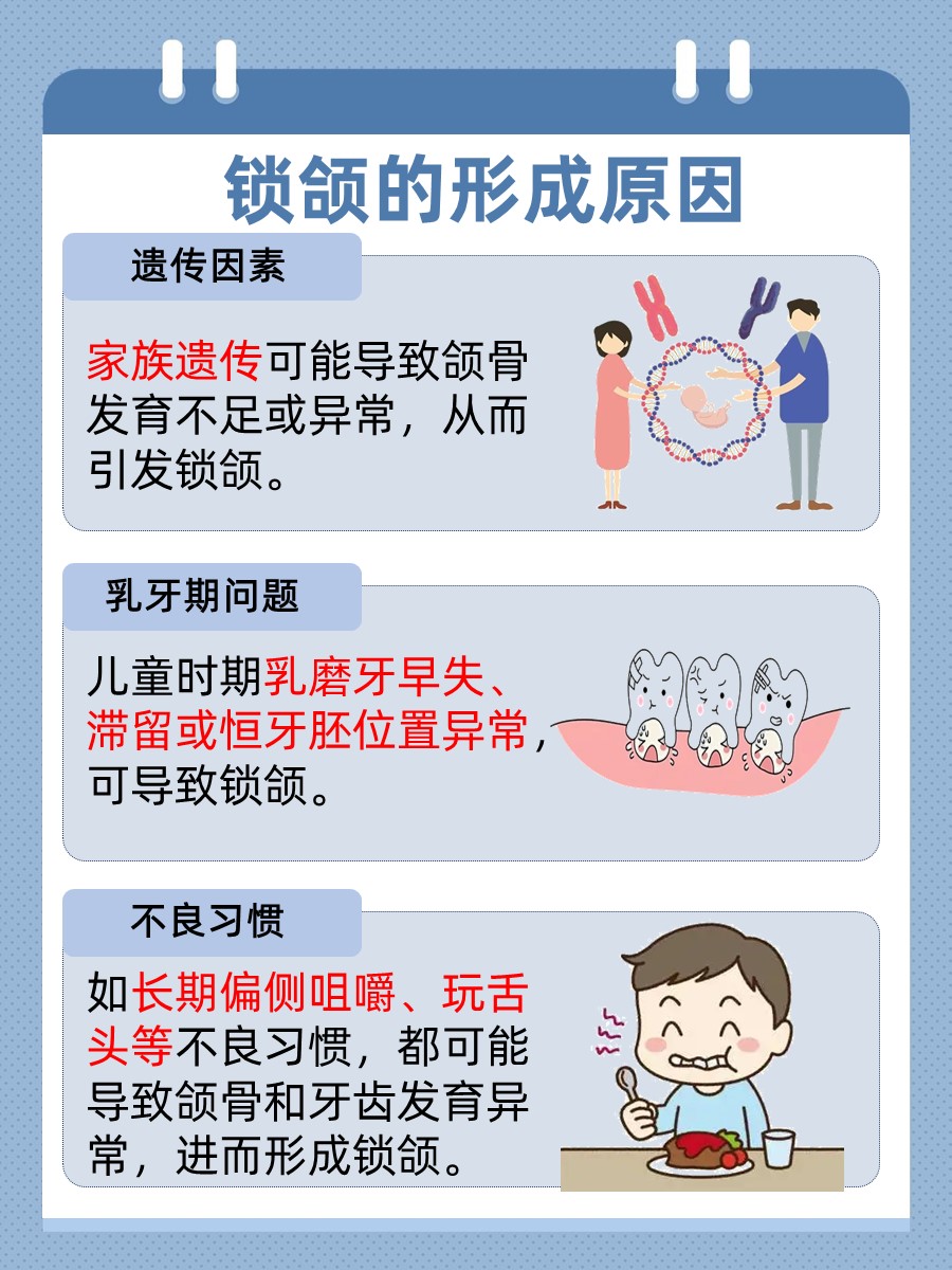 揭秘！锁颌到底什么意思？