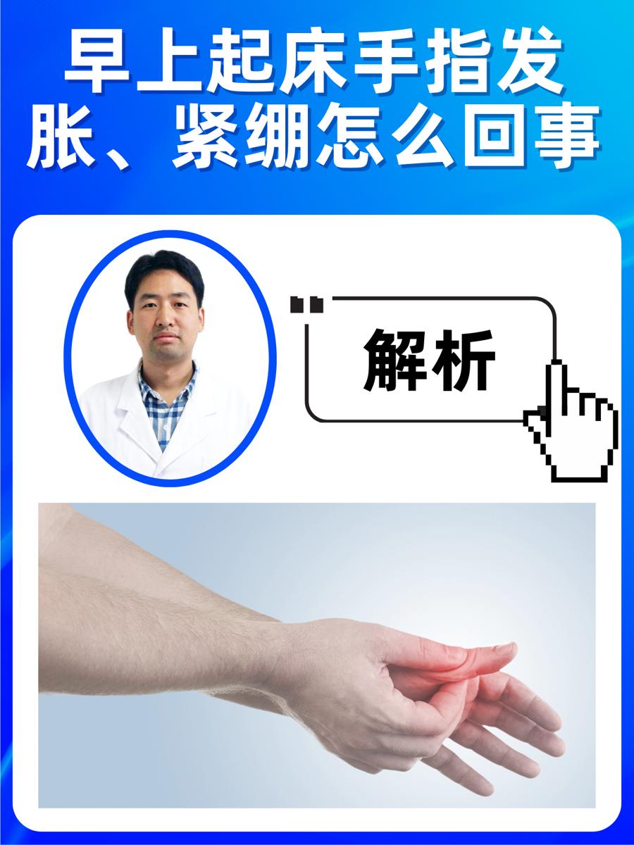 解析:早上起床手指发胀、紧绷怎么回事