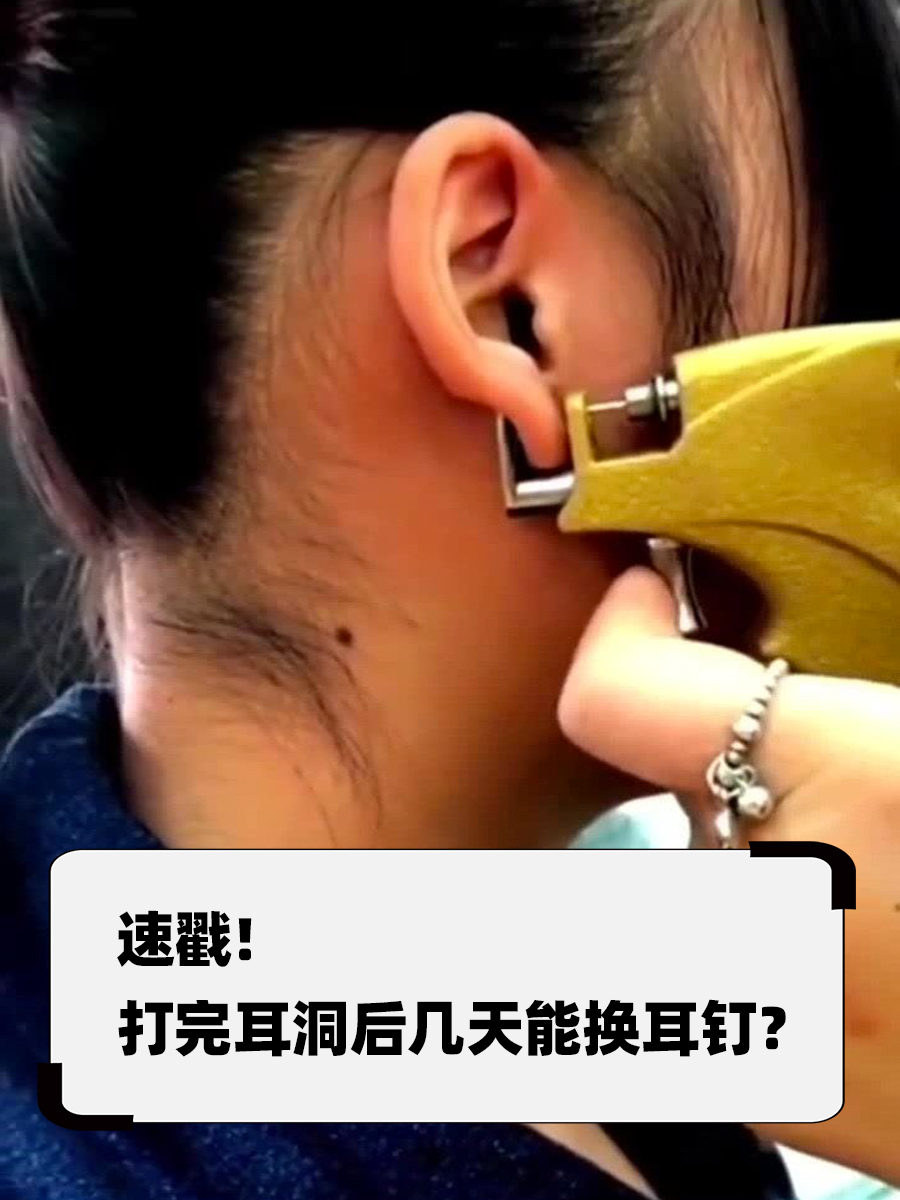 速戳！打完耳洞后几天能换耳钉？
