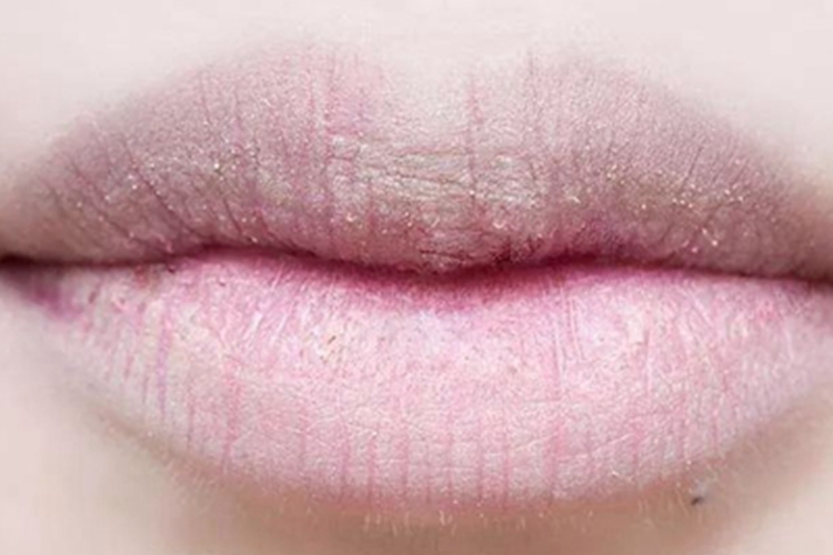 接触性唇炎嘴唇皮肤颜色变浅图