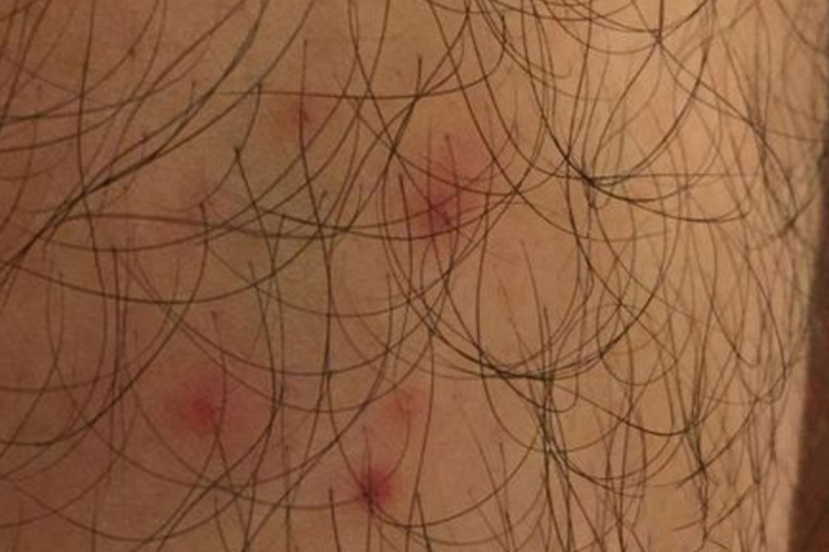 十二三岁小孩阴毛图 十二三岁小孩阴毛图