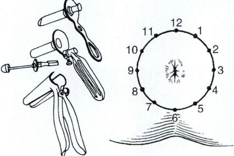 十二点位示意图