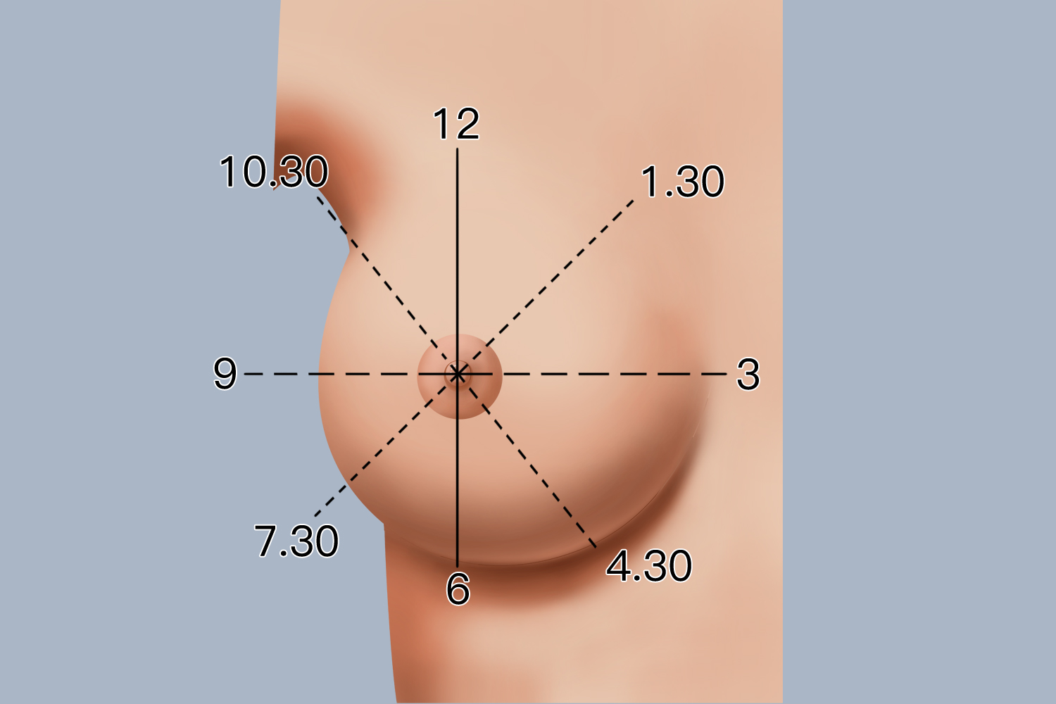 左乳12点位置图片图片