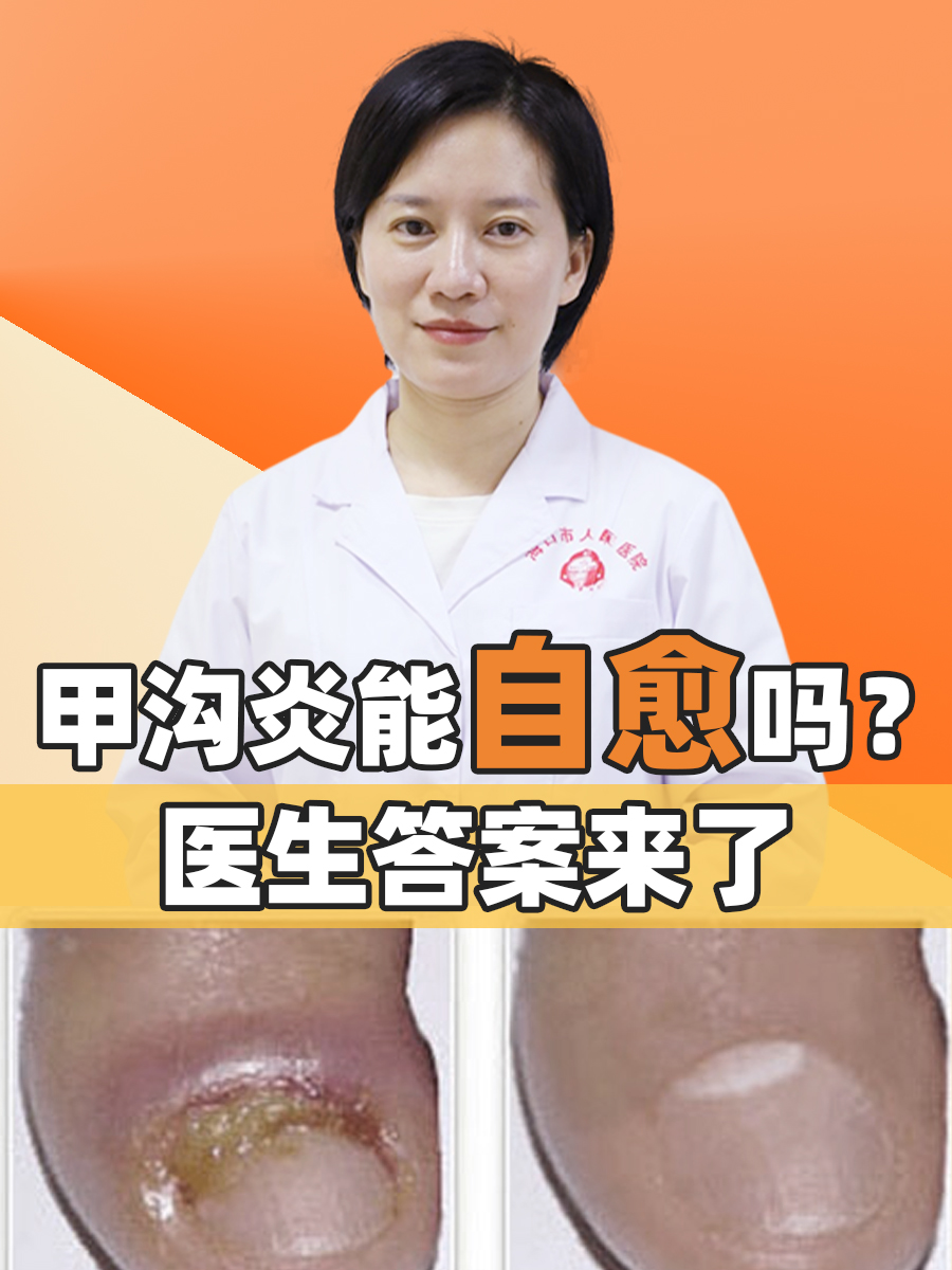 甲沟炎能自愈吗？医生答案来了