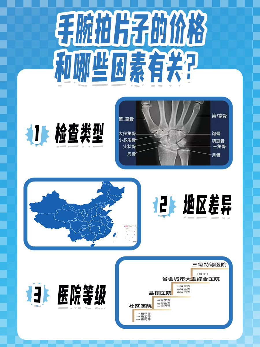 手腕拍片子需要多少钱？不贵，这个钱不能省！