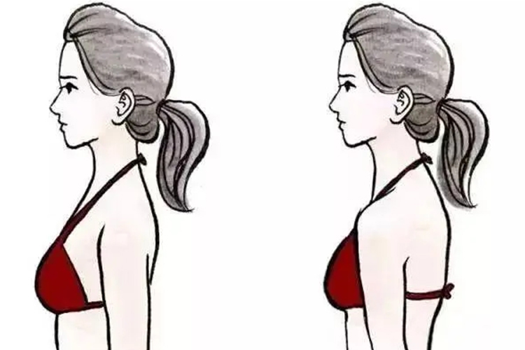 圆肩与正常肩区别图