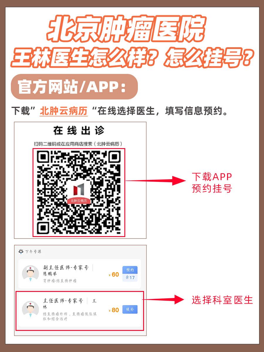 北京肿瘤医院王林医生怎么样？怎么挂号？