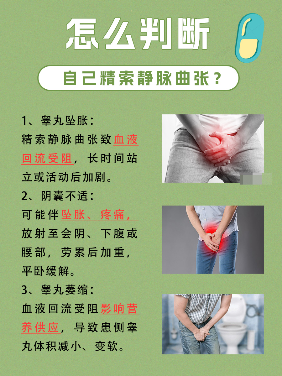 判断自己精索静脉曲张：这篇文章告诉你答案