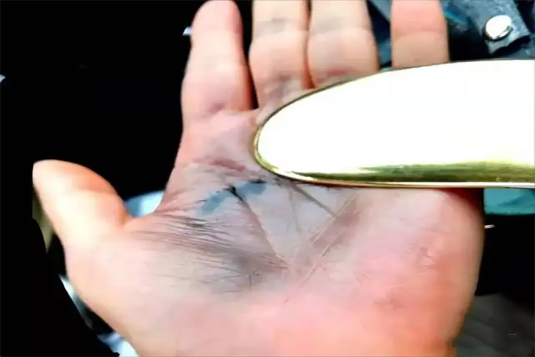 手掌刮痧示意图 手掌刮痧示意图