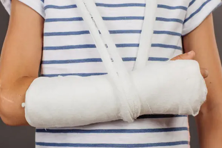 手臂闭合性骨折图