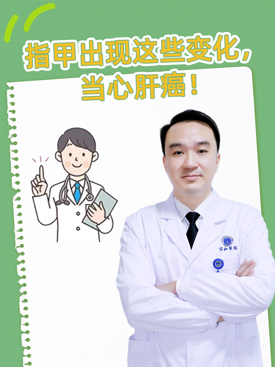 指甲出现这些变化,当心肝癌!