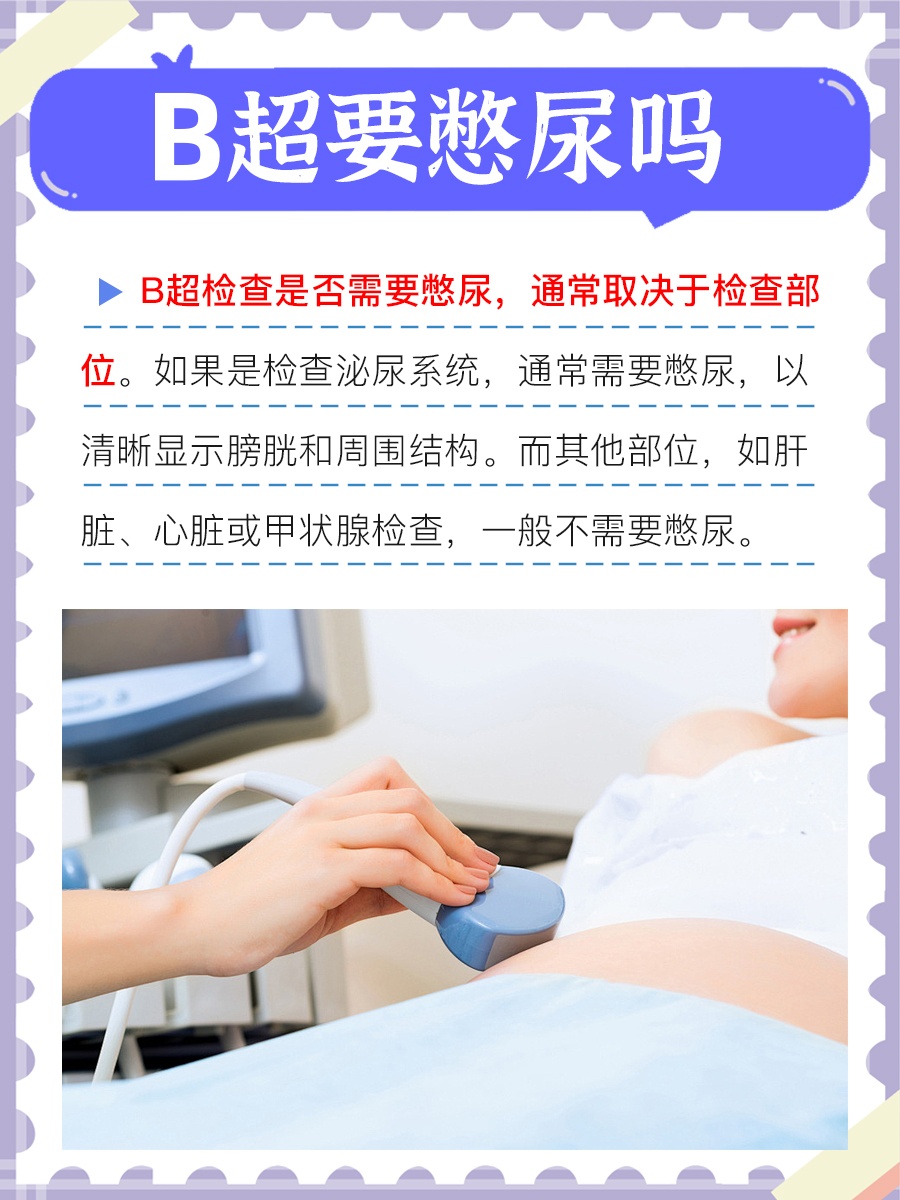 做B超需要憋尿吗？答案出乎意料！