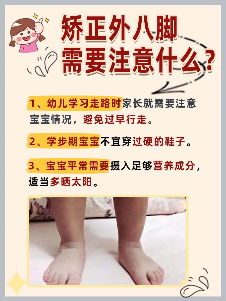 外八脚不再尴尬,轻松矫正走起!