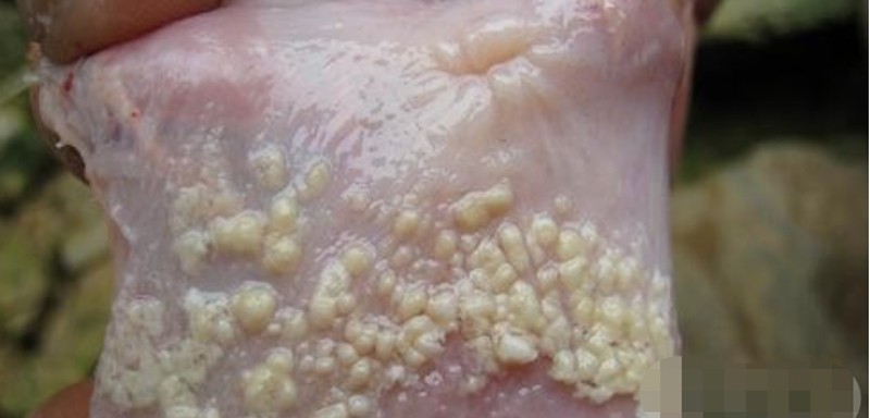 龟头霉菌感染症状图片图片