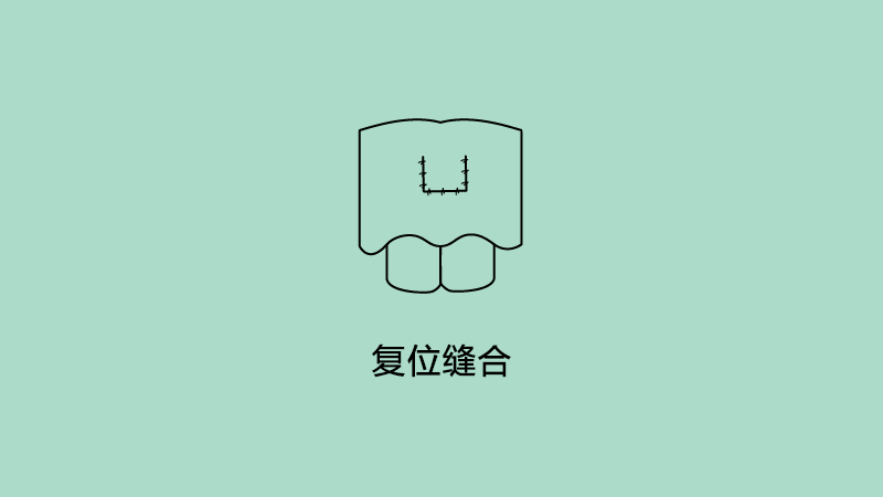 复位缝合.png
