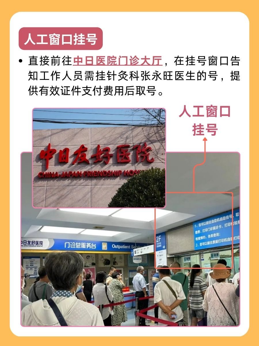 中日友好医院张永旺医生怎么样？怎么挂号？