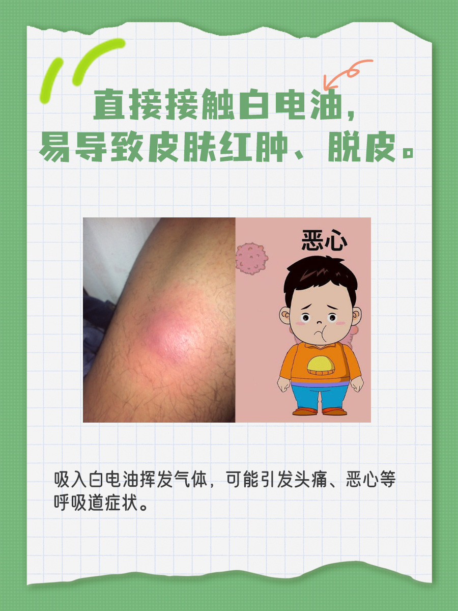 医生揭秘！白电油对人体有什么危害