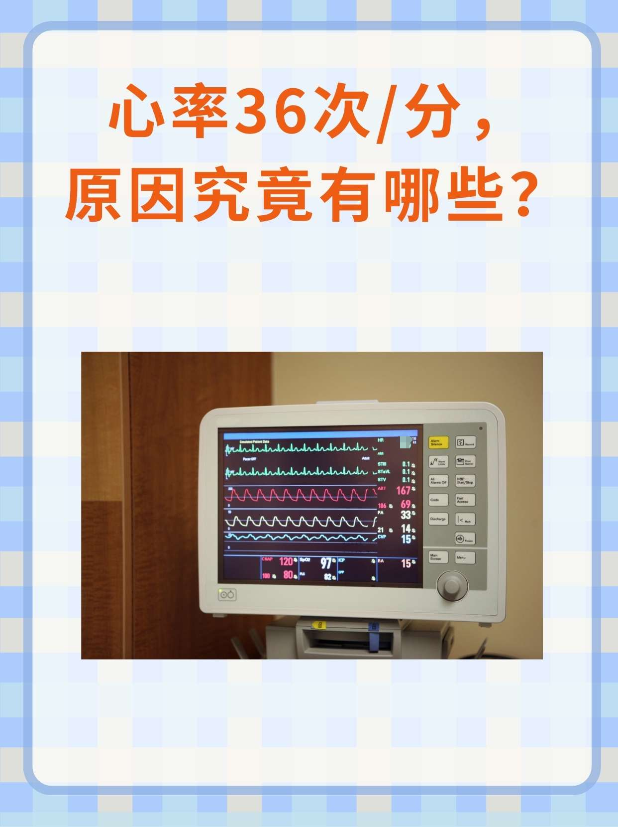 心率36次/分，原因究竟有哪些？
