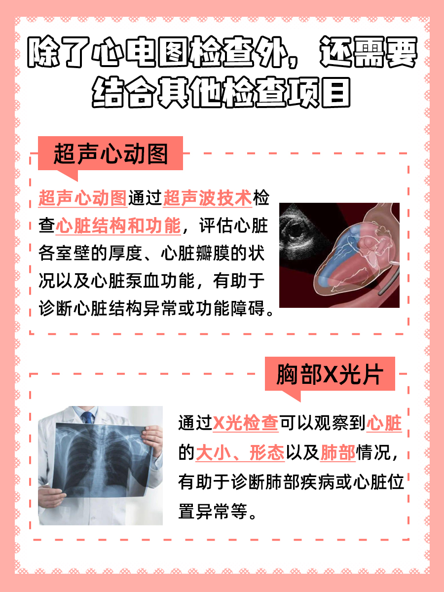 心电图上的小秘密：解读右偏现象