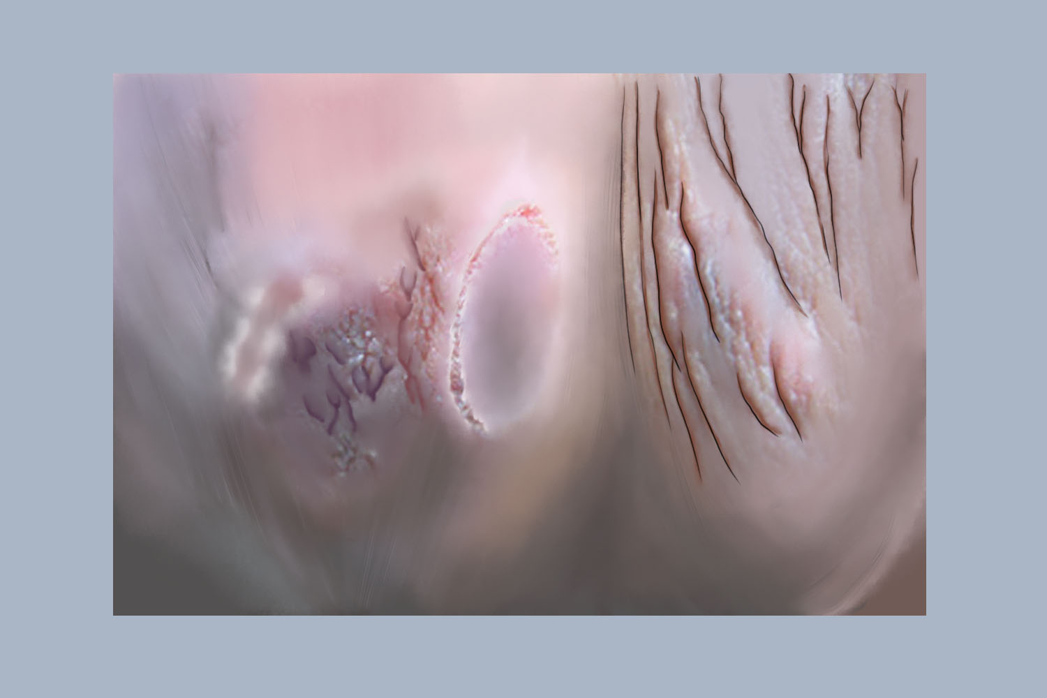 皮损波及阴囊图