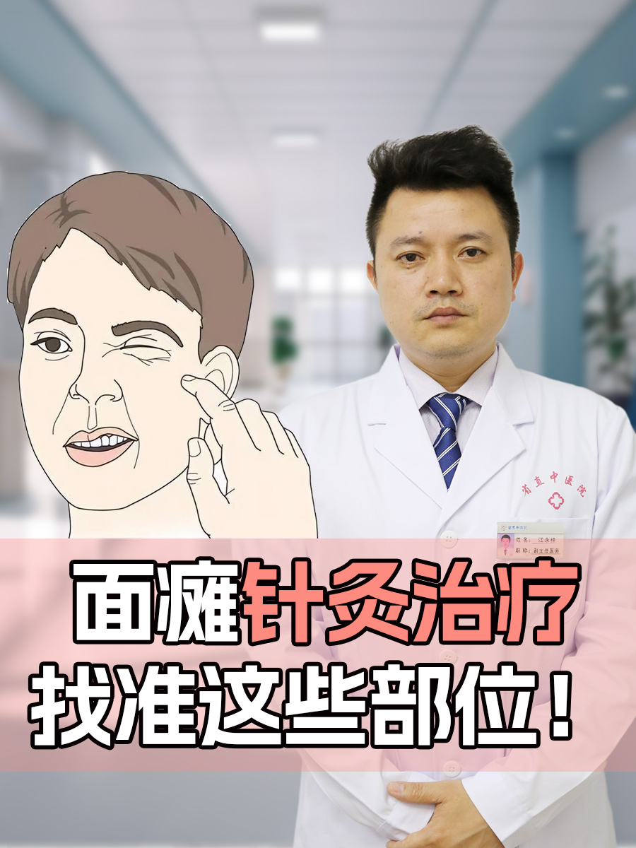 面瘫针灸治疗，找准这些部位！
