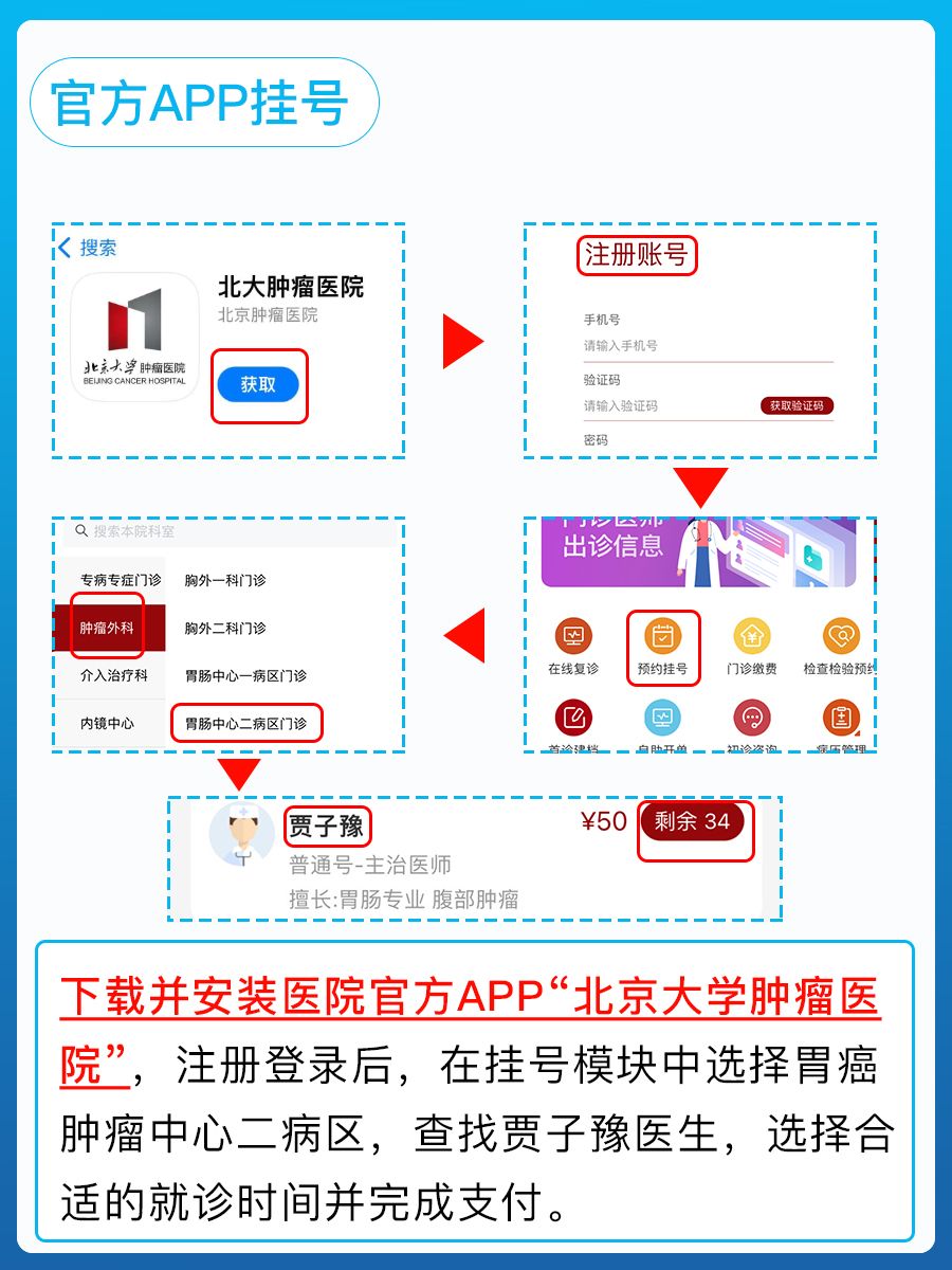北京大学肿瘤医院贾子豫医生怎么样？怎么挂号？
