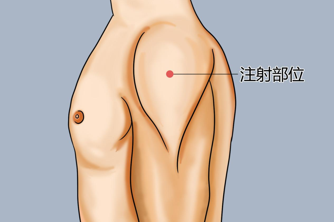 上臂三角肌注射定位图 上臂三角肌注射定位图