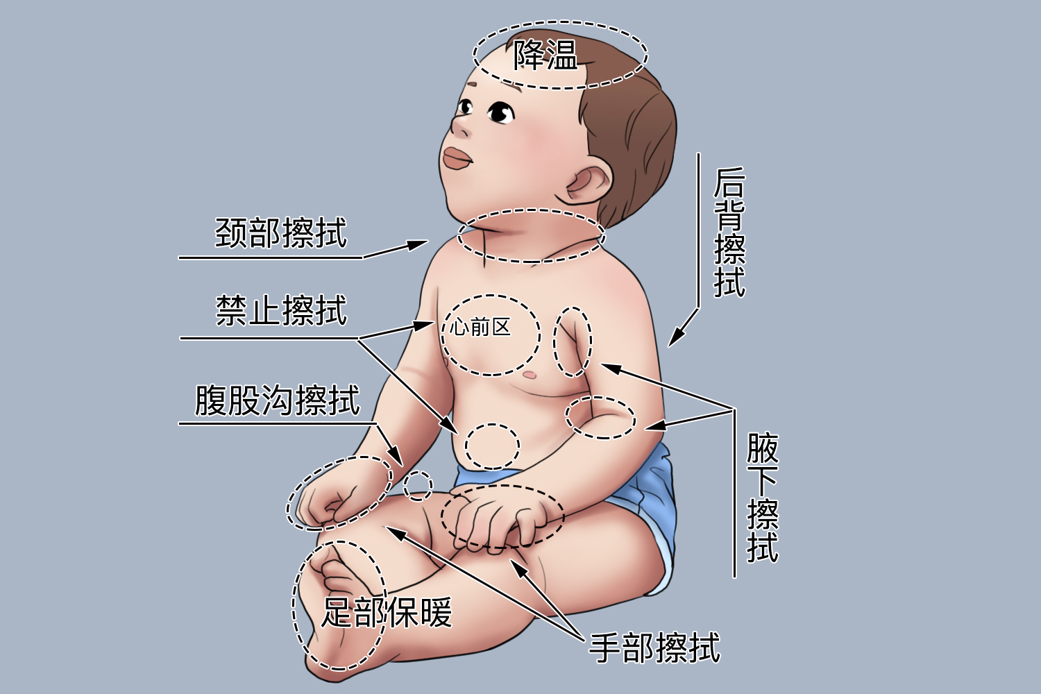 小儿拭浴降温位置图
